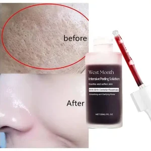 Korean Salicylic Acid Pore Serum